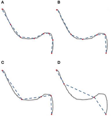 Visualization, Interaction and Tractometry: Dealing with Millions of Streamlines from Diffusion MRI Tractography